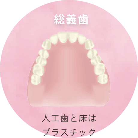 総義歯：人工歯と床はプラスチック